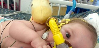 спинальная мышечная атрофия