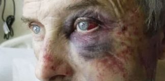 Олег Козаченко